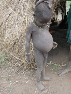 Hungry Kwegu child after the Omo River failed to flood (2009)